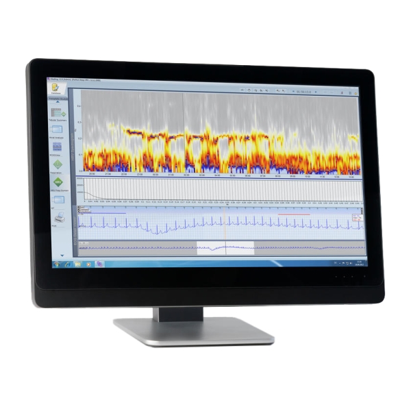 NxStage Versi™HD AVOMA GROUP